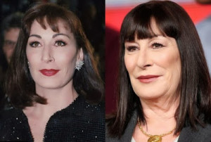 Angelica Huston Plastic Surgery Before And After Photos – Something Went Wrong