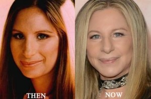 Barbra Streisand Plastic Surgery Before and After Photos