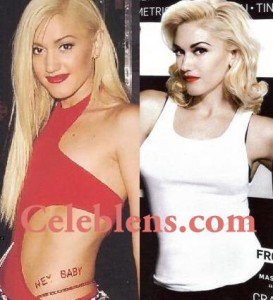 Gwen Stefani Plastic Surgery Before And After Photos