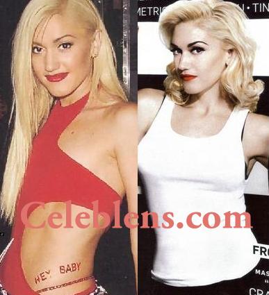 gwen stefani plastic surgery before and after photos breast augmentation