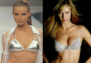 Heidi Klum Plastic Surgery Before And After Photos