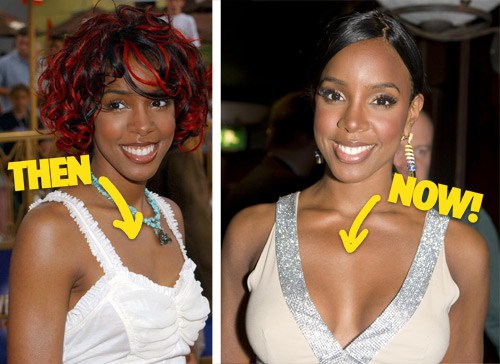 kelly rowland breast implants before and after photos