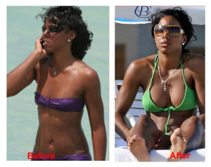 Kelly Rowland Breast Implants Before And After Photos