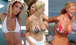 Celebrities Plastic Surgery Gone Wrong – 10 Regrets