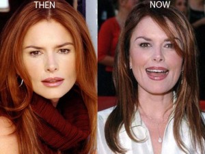 Roma Downey Plastic Surgery Before And After Photos