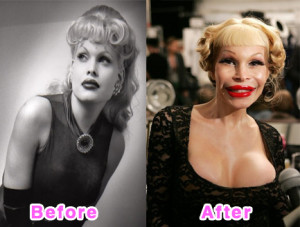 Top 10 Celebrities With Bad Plastic Surgery Photos