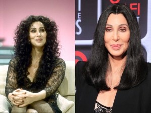 Goddess Of Pop, Cher Plastic Surgery Before And After Photos