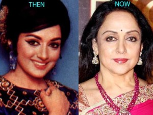Hema Malini Plastic Surgery Before And After Photos