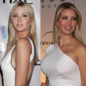 Ivanka Trump Plastic Surgery Before And After Photos