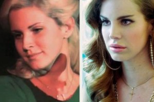 Lana Del Rey Plastic Surgery Before And After Photos