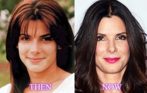 Sandra Bullock Turned 50, Plastic Surgery To Stay Young