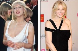Courtney Love Plastic Surgery Before And After Photos