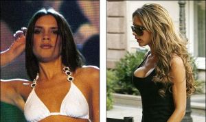 Victoria Beckham Plastic Surgery Before And After Photos
