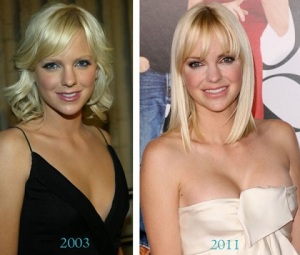 Anna Faris Plastic Surgery Before And After Photos