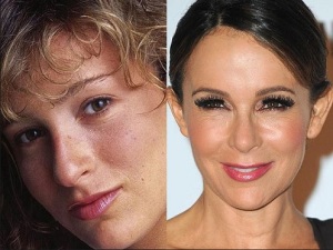 Jennifer Grey Plastic Surgery Before And After Photos
