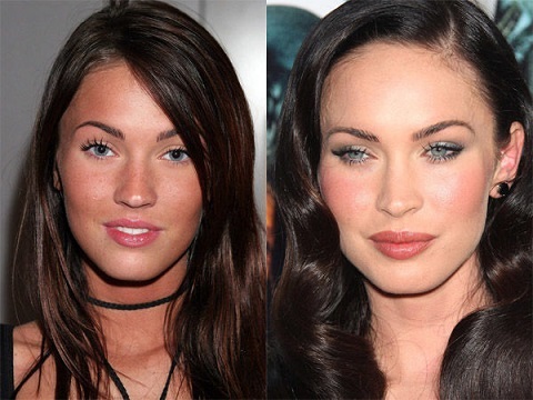 Megan Fox plastic surgery, Megan Fox plastic surgery before after photos, Megan Fox nose job, has Megan Fox had plastic surgery, lip injections, fillers1