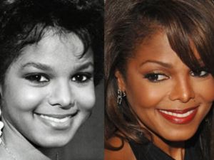Janet Jackson plastic surgery, Janet Jackson plastic surgery before after photos, Janet Jackson breast augmentation, breast implants, facelift, nose job, botox, nose job1