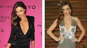 Top 7 Victoria’s Secret Models Who’ve Had Plastic Surgery