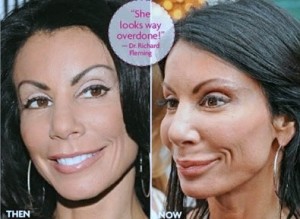 Danielle Staub Plastic Surgery Before And After Photos