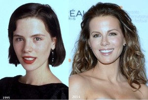 Kate Beckinsale Plastic Surgery Before And After Photos