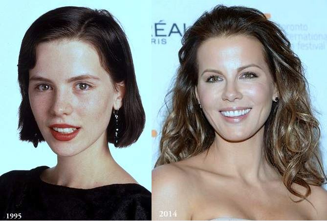 Kate Beckinsale plastic surgery, Kate Beckinsale breast implants, Kate Beckinsale before after photos, nose job, cosmetic surgery0
