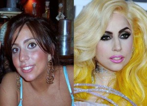 Lady Gaga Plastic Surgery Before And After Photos
