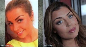 Abi Clarke Plastic Surgery Before And After Photos