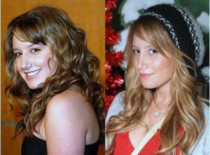 Ashley Tisdale Plastic Surgery Before And After Photos