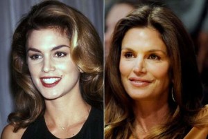 Cindy Crawford Plastic Surgery Before And After Photos