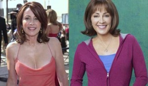 Patricia Heaton Plastic Surgery Before And After Photos