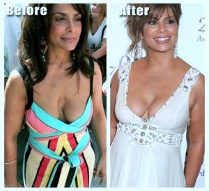 Paula Abdul Plastic Surgery Before And After Photos