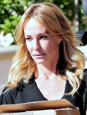 Taylor Armstrong photos, Taylor Armstrong plastic surgery, breast implants, lip injection, reconstructive surgery, cosmetic surgery, Taylor Armstrong cosmetic surgery