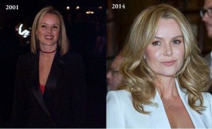 Amanda Holden Plastic Surgery Before And After Photos