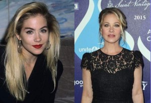 Christina Applegate Plastic Surgery Before And After Photos