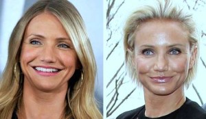 Cameron Diaz Plastic Surgery Before And After Photos