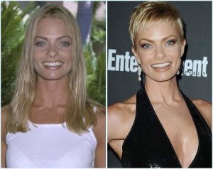 Jaime Pressly Plastic Surgery Before And After Photos