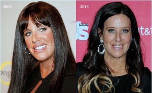 Patti Stanger Plastic Surgery Before And After Photos
