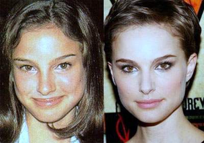Natalie Portman plastic surgery, Natalie Portman photos, Natalie Portman nose job, Natalie Portman before after plastic surgery photos2