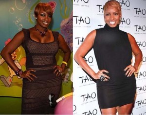 NeNe Leakes Plastic Surgery Before And After Photos