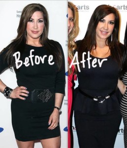 Jacqueline Laurita Plastic Surgery Before And After Photos