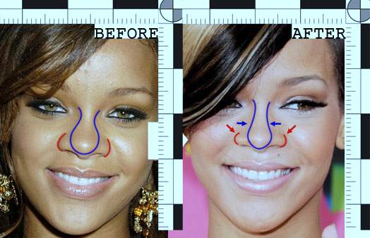 Rihanna plastic surgery, Rihanna nose job, rhinoplasty, breast implants, before after photos, Rihanna before after photos, Rihanna photos0