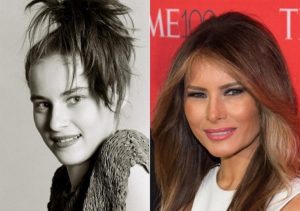 Melania Trump Plastic Surgery Before And After Photos