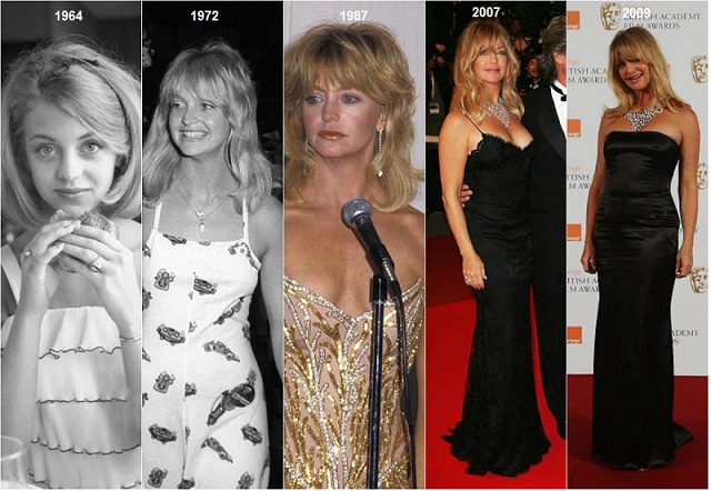 goldie-hawn-plastic-surgery-goldie-hawn-now-and-then-goldie-hawn-plastic-surgery-before-after-photos-goldie-hawn-face-timeline-goldie-hawn-2017.jpg?profile=RESIZE_710x
