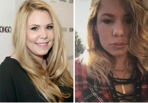 kailyn lowry plastic surgery before after, kailyn lowry breast implants, brazilian butt lift, lip fillers, kailyn lowry tummy tuck, liposuction, kailyn lowry teen mom plastic surgery1