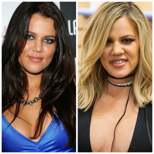 khloe kardashian plastic surgery, celebrities plastic surgery gone wrong, khloe kardashian plastic surgery before after photos